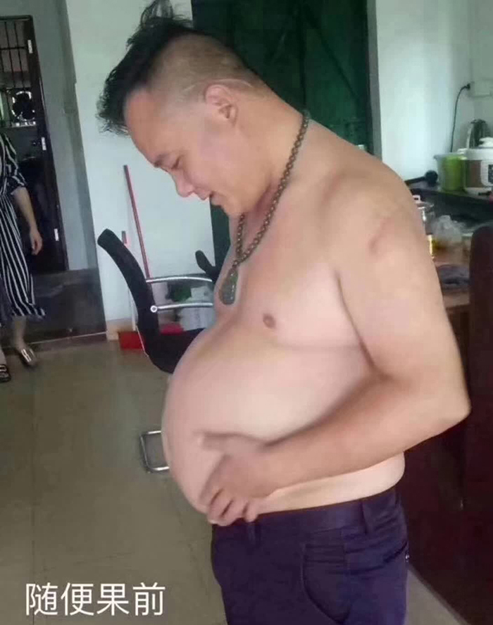 邹先生吃随便果+四季代餐成功甩掉大肚囊，亚健康也跟着调理好了