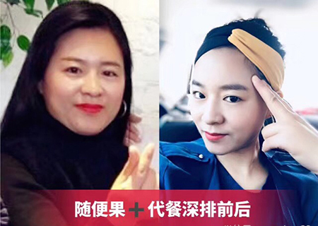 美女参加随便果深排两次成功瘦身20斤