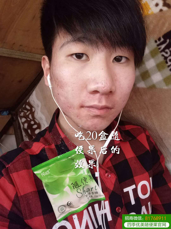 四季优美随便果祛痘、淡斑效果看得见