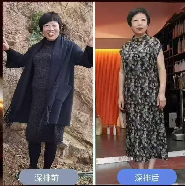 徐翠青 深排案例分享